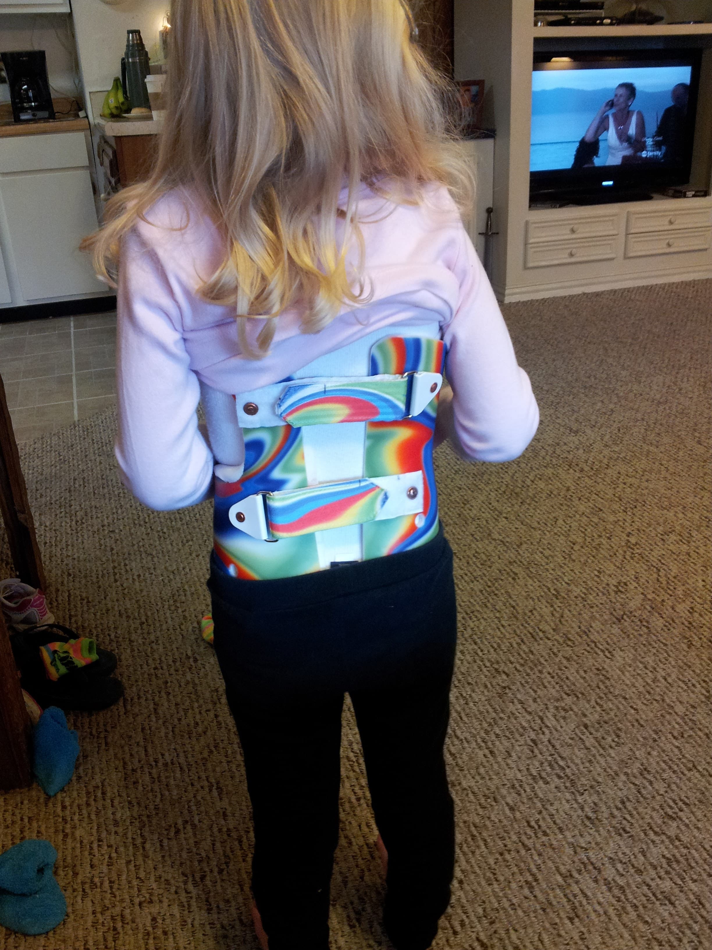 Chloe wearing her first brace, back view