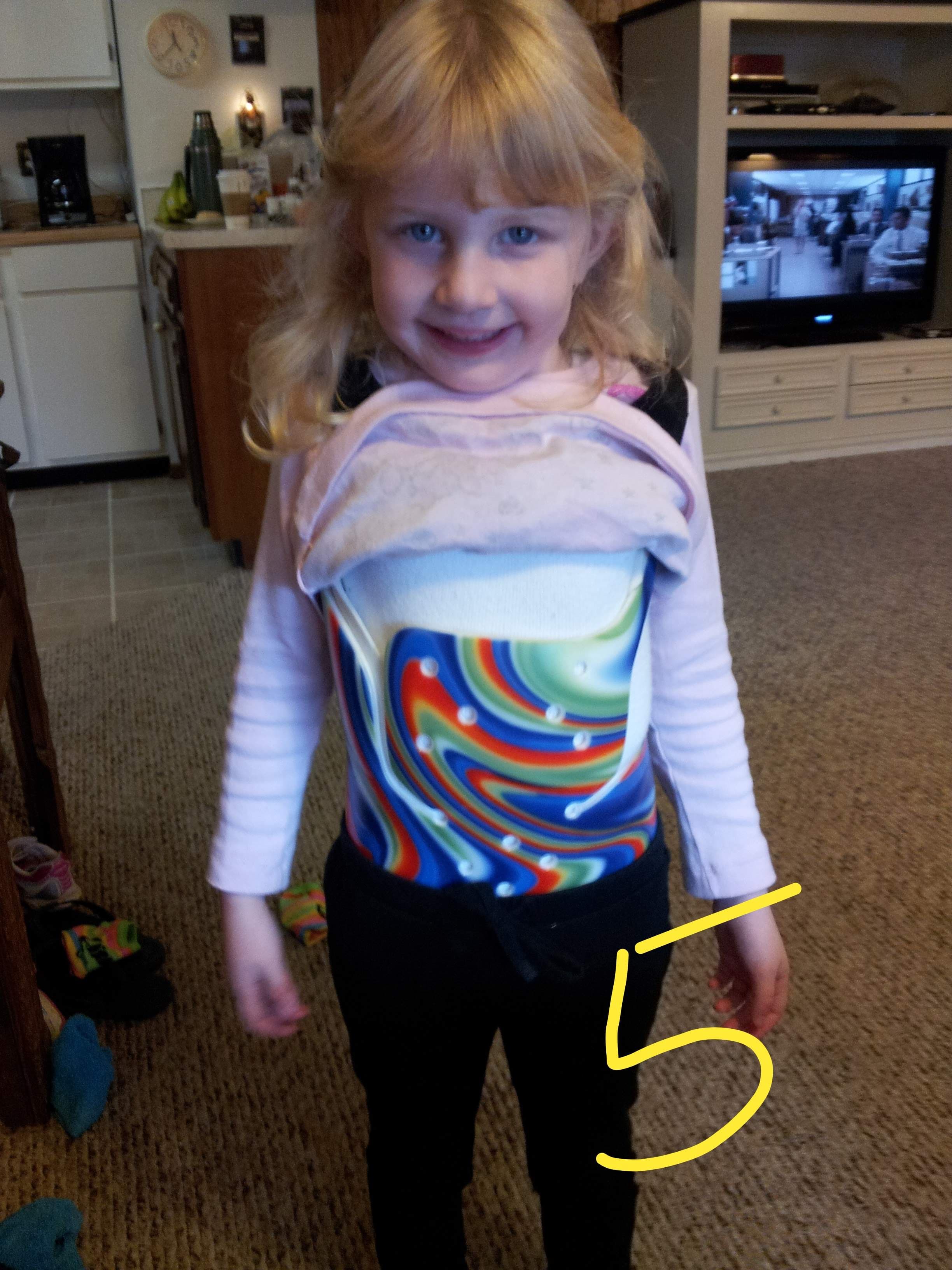 Chloe wearing her first brace, front view